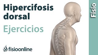 Ejercicio para eliminar por completo la hipercifosis dorsal