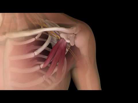 RepetitiveStress preview