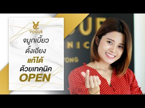 Open Rhinoplasty จมูกเบี้ยว ดั้งเอียง แก้ได้
