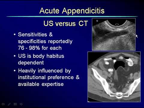 Non Gynecological Findings on Pelvic Scans 1