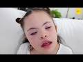 A Blind Child With Down Syndrome Who Loves Making Friends