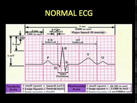 EKG BASICS