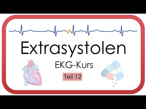 Extrasystole (Supra & Ventricular, Bigeminus, Couplet, Therapy) - ECG Course