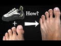 How to Treat Foot Corns Caused by Tight Climbing Shoes