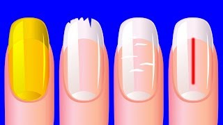 Ce Que Tes Ongles Révèlent Sur Ta Santé