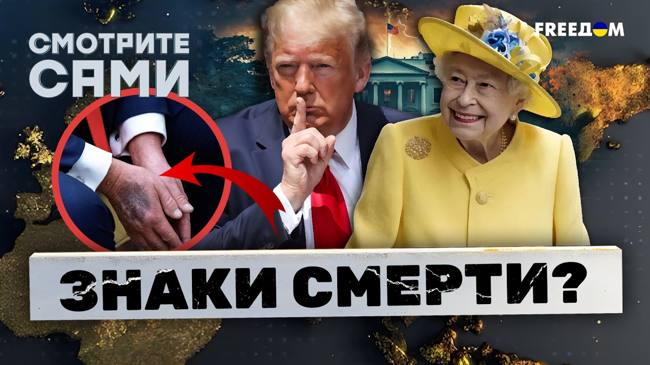 ЖУТЬ! СИНЯКИ Трампа как у КОРОЛЕВЫ Елизаветы II. ВЭНС заговорил о СМЕРТИ прези