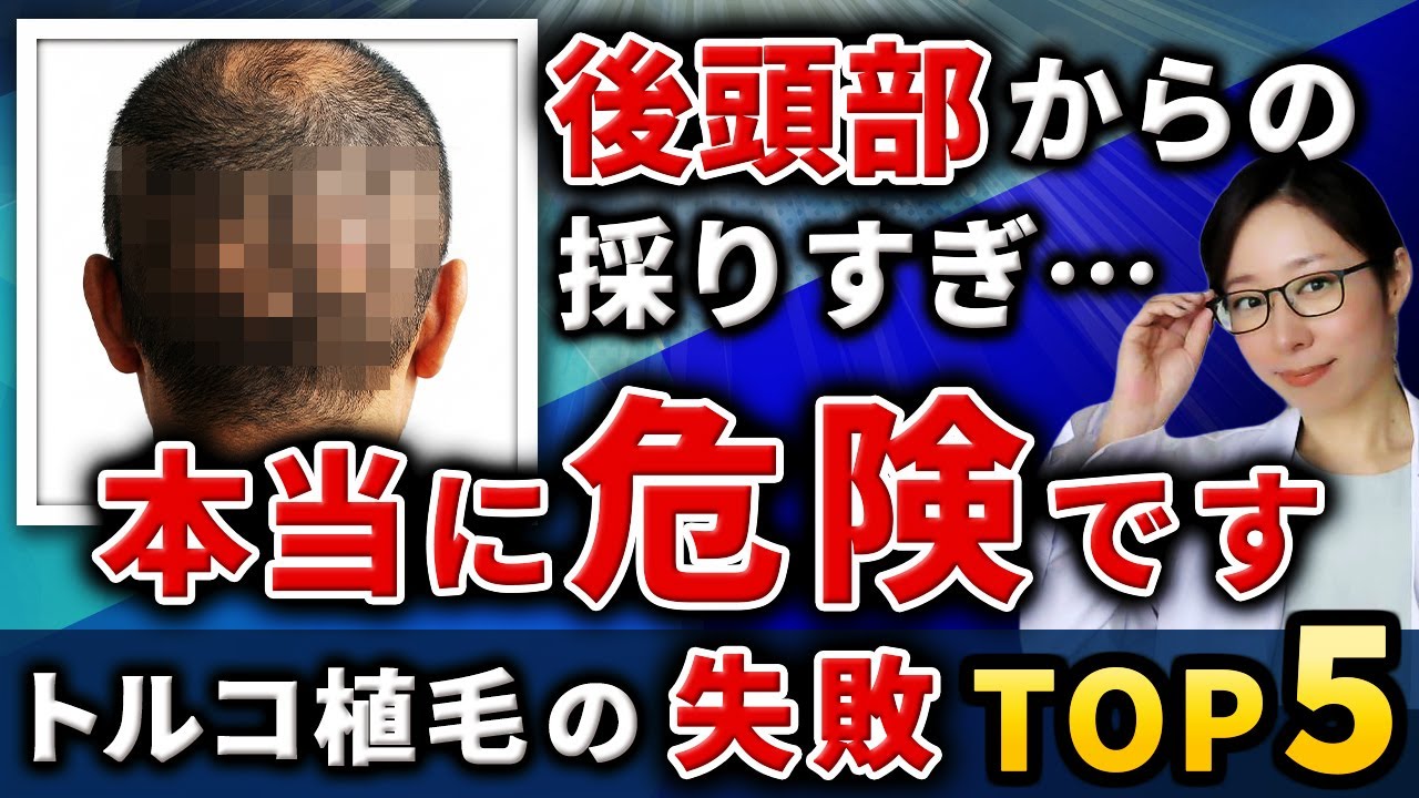 ドナーの取りすぎは取り返しがつかない｜トルコ植毛で後悔しないドナー管理の話