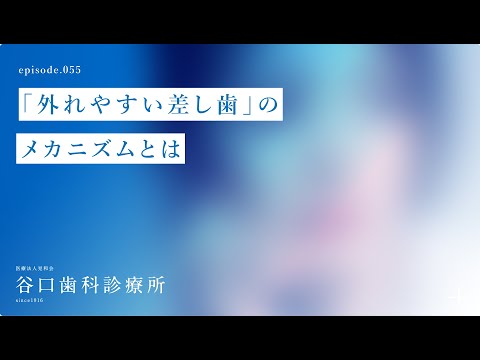 第55話 「外れやすい差し歯」のメカニズムとは⁉️札幌駅前-赤れんがテラス-谷口歯科診療所