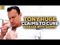 Tony Huge: