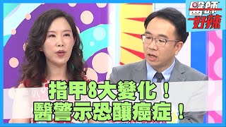 指甲8大變化要當心！這症狀恐釀「黑色素細胞癌」？！【#醫師好辣】吳昭寬 陳榮堅 張振榕 主題特映版