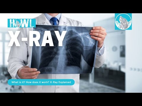 How Does a X Rays Work - How Do X Rays See Through the Skin (#Science #Education)