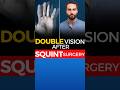 Double Vision After Squint Surgery