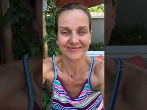 Alison’s Testimonial for Minimally Invasive Bunion Surgery - AMI Bunion By Dr. Khosroabadi