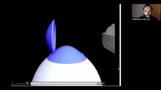 COMPLICACIONES EN CIRUGÍA REFRACTIVA