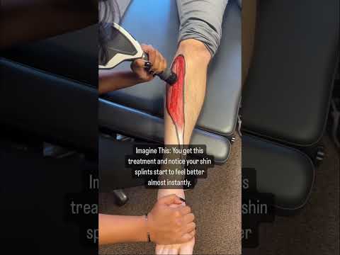 How do you treat shin splints?