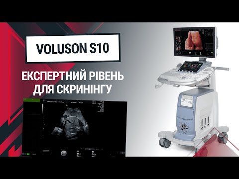 Якість скринінгу на УЗД апараті GE Voluson S10 - Статті RH