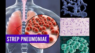 Streptococcus Pneumoniae Bacteria | Complete Overview