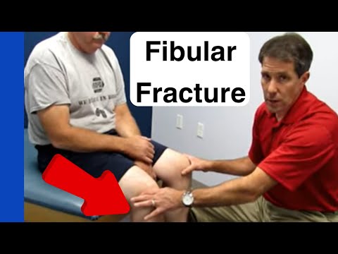Modified Lachman s Test On a patient with a COMPLETE ACL TEAR
