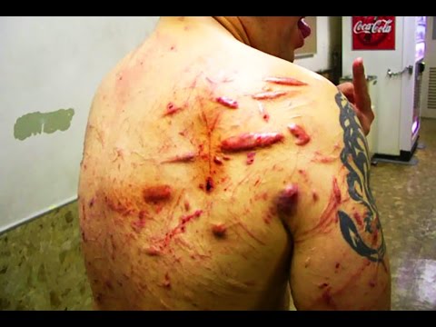 Chi ha lalcolismo La prova su un alcolismo soggetto