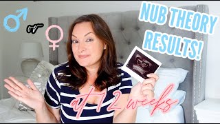 HOW TO GUESS YOUR BABY'S GENDER NUB THEORY EXPLAINED AND MY RESULTS! 12 WEEK GENDER REVEAL!