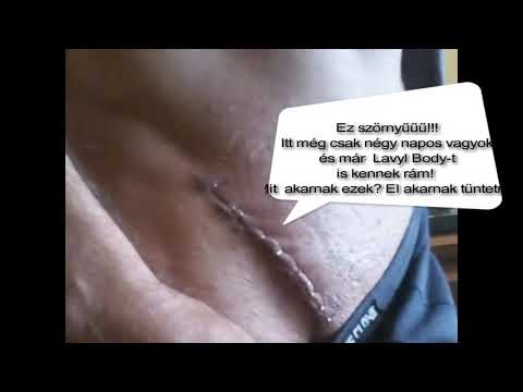 fellépés a péniszen viagrával