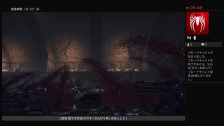 ［ダークソウル3］グダグダ楽しみたいLIVE配信