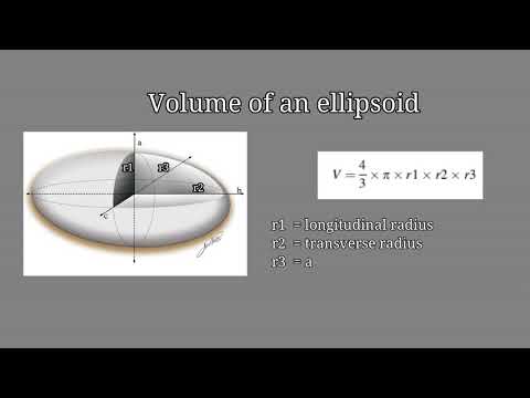 Giant hernias: how to calculate hernia sac and abdominal volume on CT scan