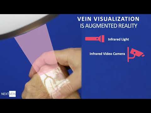 Videos from NextVein