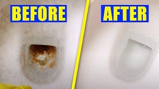 How to Clean a Toilet With Vinegar and Baking Soda