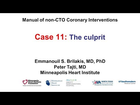 Case 11: PCI Manual - The "culprit"