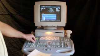 Sequoia 512 Ultrasound Demo