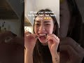 Haven T Worn Retainer In Months And It Hurts Orthodontist Reacts