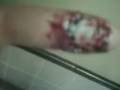 Dan's bloody finger