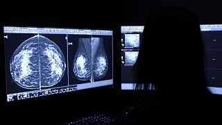 Mayo Clinic Minute - What does a dense breast tissue diagnosis mean