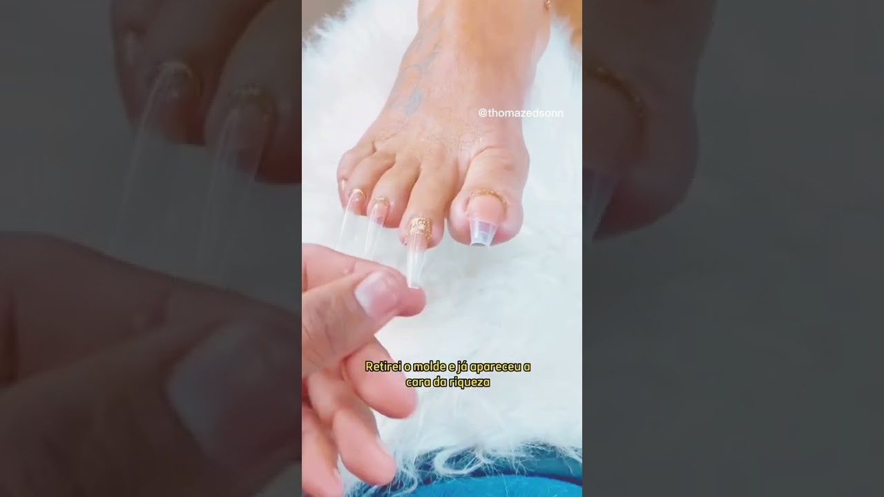 Dual forms no mold f1 na unha do pé