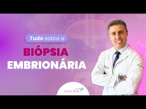 Reproduzir Vídeo