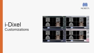 Did you know that you can customize i-Dixel to improve data visualization, change the layout to suit your workflow or even modify the color scheme?…