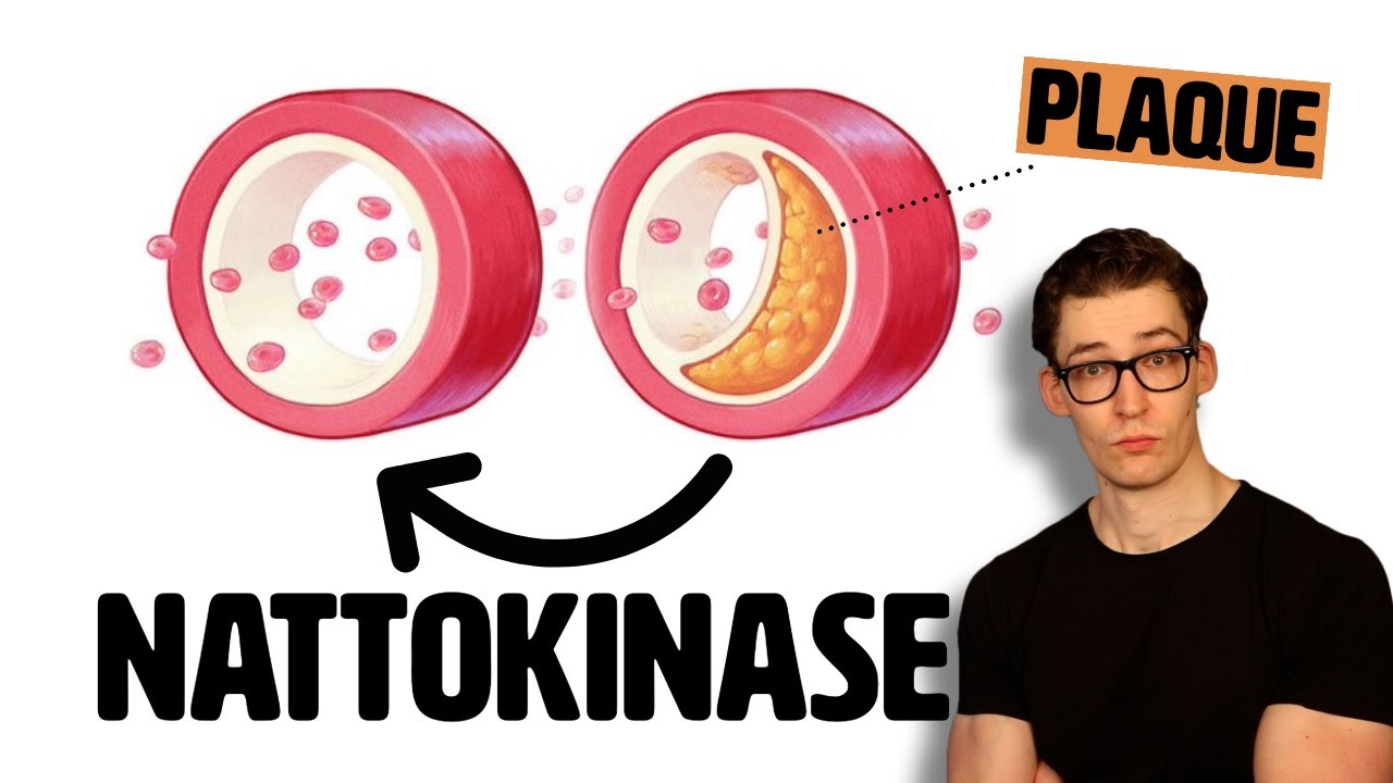 Nattokinase: Plaque Reversing Supplement, or Biased Science?