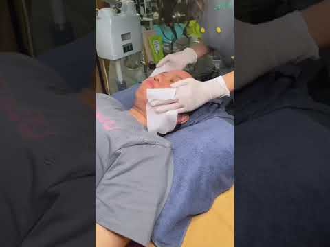 Video peel da tại Lâm Kiều Spa