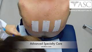 Patch Testing at Advanced Specialty Care