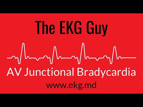 AV Junctional Bradycardia EKG l The EKG Guy - www.ekg.md