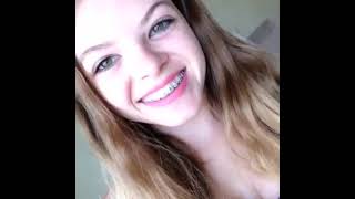 Braces smile compare few bikinis in mirror