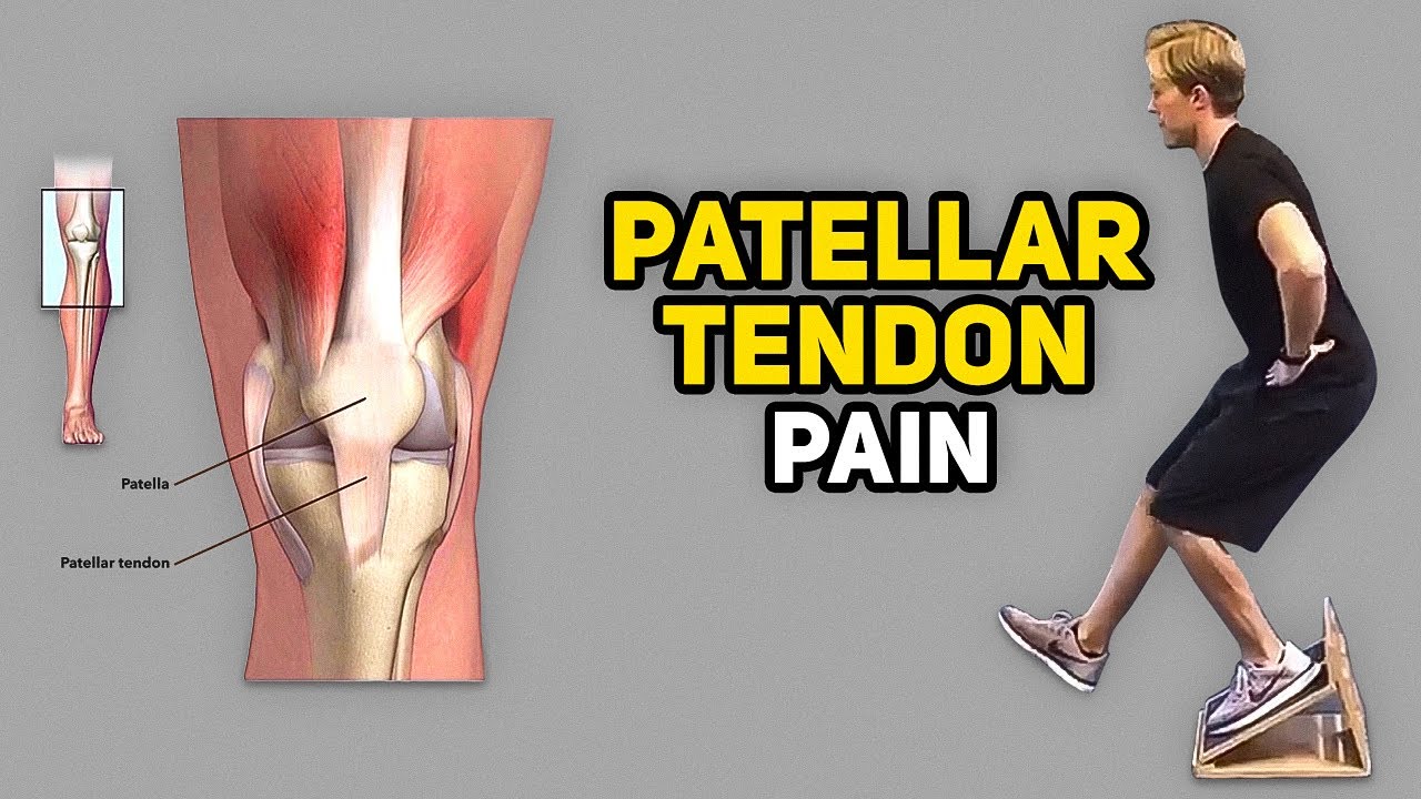 3 Exercises for Jumper’s Knee (Patellar Tendinopathy)