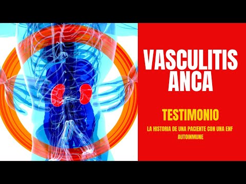 Vasculitis Anca