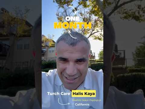 1 Month After Hair Transplant 🌱 #turchcare #hairtransplant #istanbul #CaliforniaBasedAgency