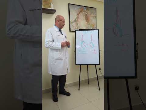 Seton best treatment for anal fistula?