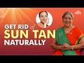 Remove Skin Tan With These 5 Natural Home Remedies Glowing Even Skin Tone Sun Tan