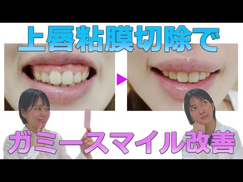 粘膜について詳しく解説