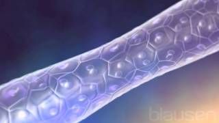 ¿Qué es la Anemia Falciforme?