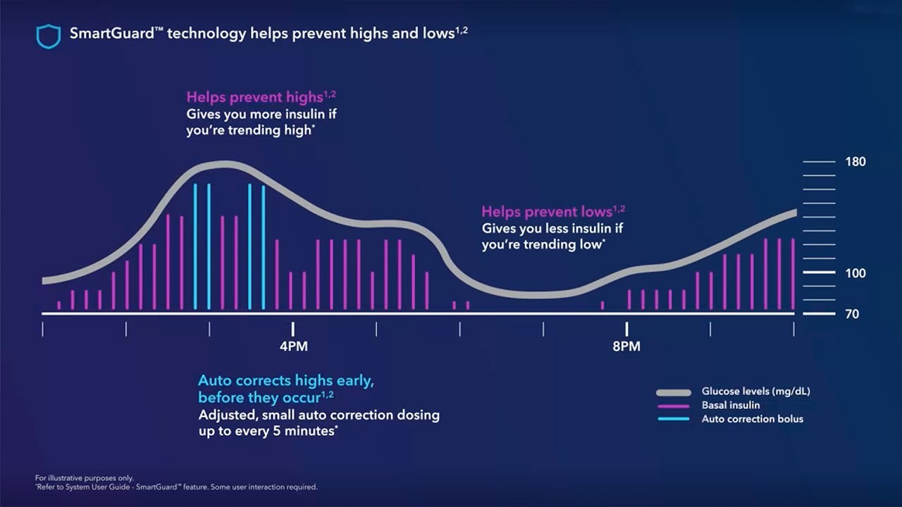 This video provides tips for using the SmartGuard feature on your MiniMed 780G system.